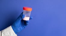 Homem é preso por urinar e ejacular em itens e alimentos de colegas e postar na internet